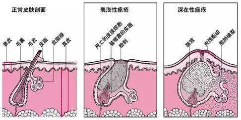 治療痤瘡的最好醫(yī)院,治療痤瘡的最好醫(yī)院，系統(tǒng)化分析與說明,科學解答解釋定義_進階版18.44.30