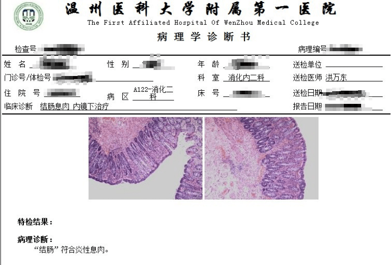 慢性附件炎會癌變嗎